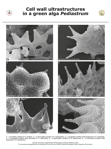 Ultrastruktura powierzchni komórek przedstawicieli rodzaju Pediastrum